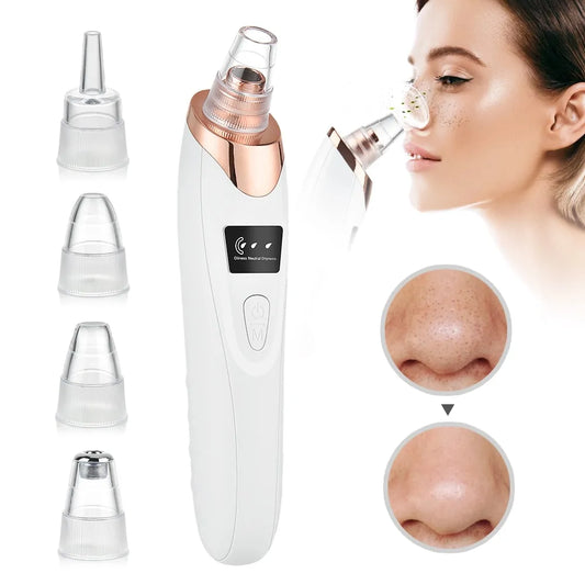 Healvanas Blackhead Remover Vacuum